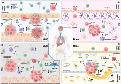 The effect of organ-specific tumor microenvironments on response patterns to immunotherapy